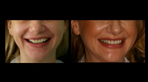 Before and after images showing Dr. Schrotts results