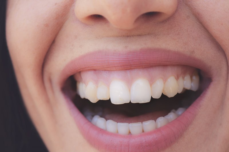 Close-up of a woman’s smile with healthy gums