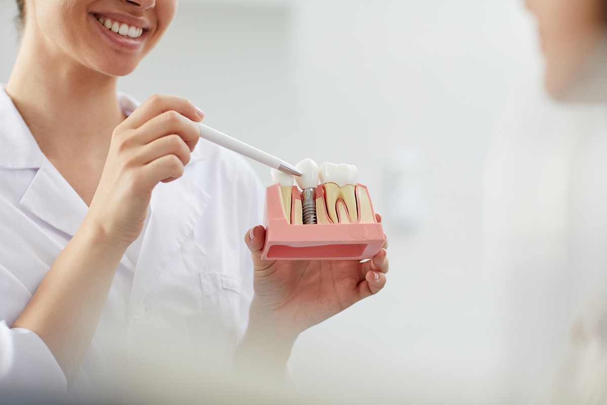 How Long After Dental Implants Can You Eat Normally?
